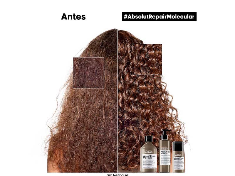 Antes y despues de tratamiento para recuperar la elasticidad